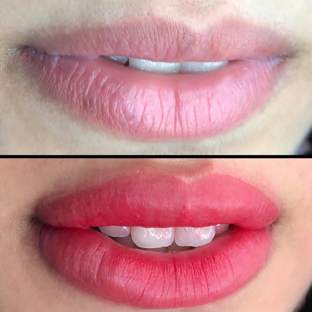 Antes e depois dos lábios com a cor corrigida